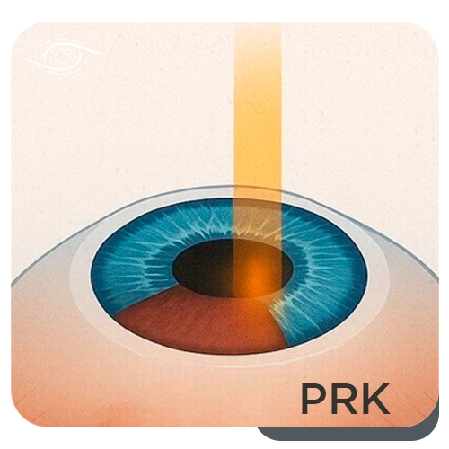 PRK